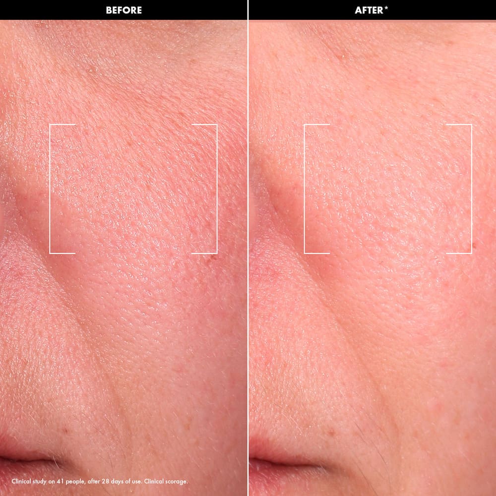 LET'S GET GLOWY SET (SET DE RUTINA FACIAL LUMINOSA)